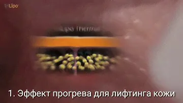 Радиоволновой лифтинг и липолиз Trilipo Maximus в Центре косметологии ALTEOS Beauty